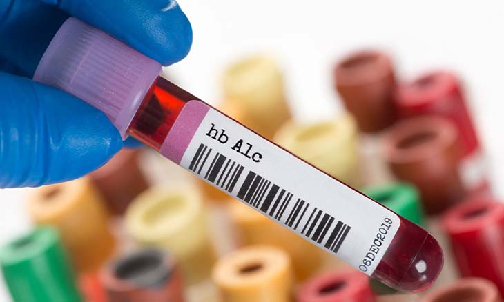 HbA1c